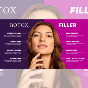 Botox vs fillers anti-aging treatment at Aspire Aesthetics