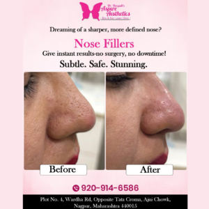 non surgical nose fillers at aspire aesthetics 