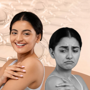 skincare mistakes damaging skin barrier