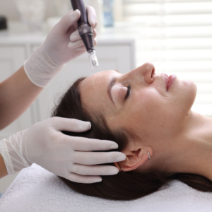 microneedling benefits for skin