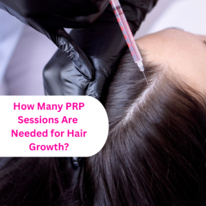 PRP sessions for hair growth results