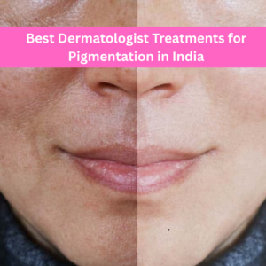 Best Dermatologist Treatments for Pigmentation in India