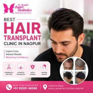 Best Hair Transplant Clinic in Nagpur